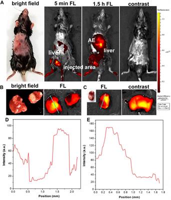 NIR-II fluorescence microscopic bioimaging for intrahepatic angiography and the early detection of Echinococcus multilocularis microlesions